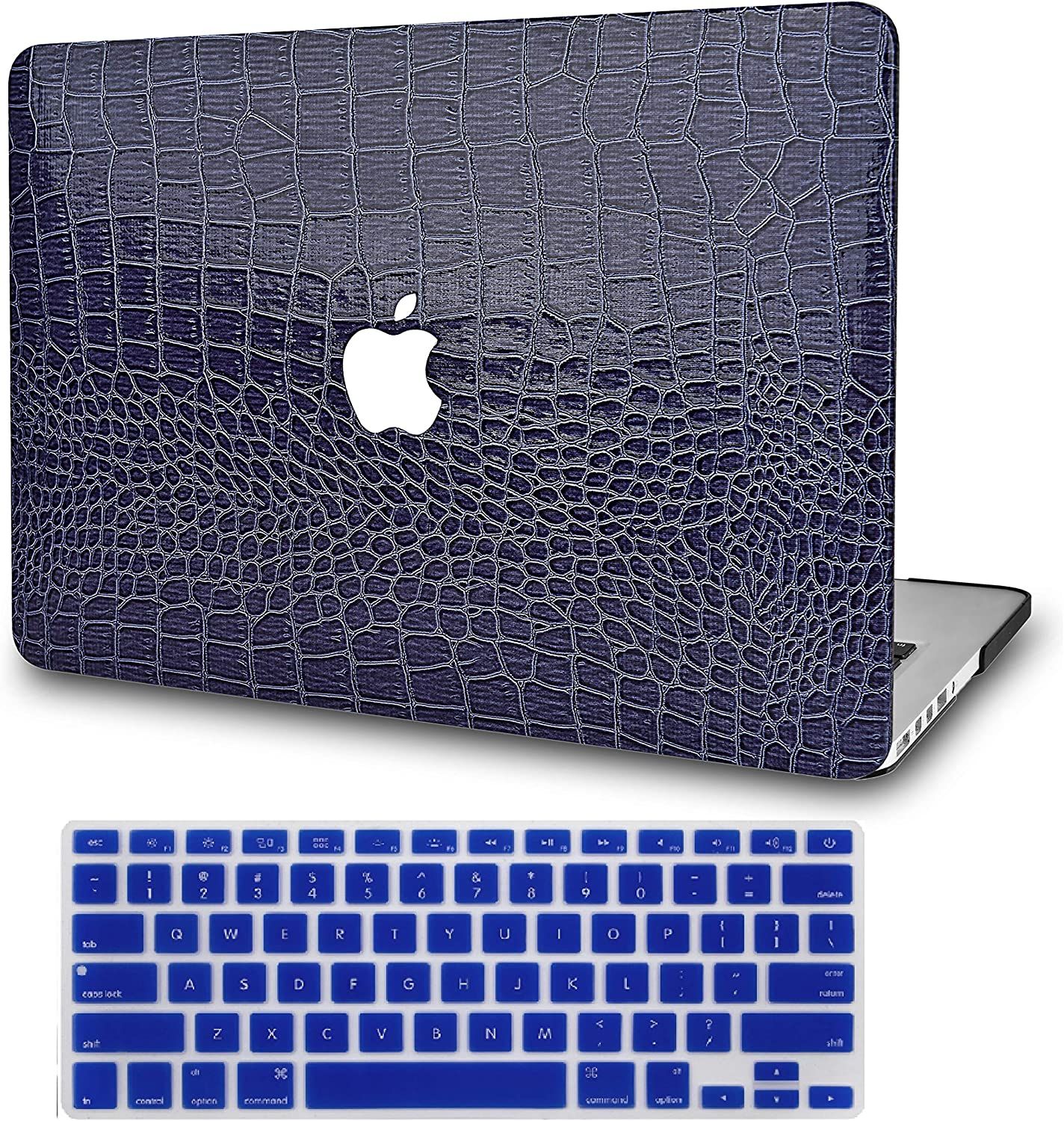 What are the best cases for macbook pro rightlasopa