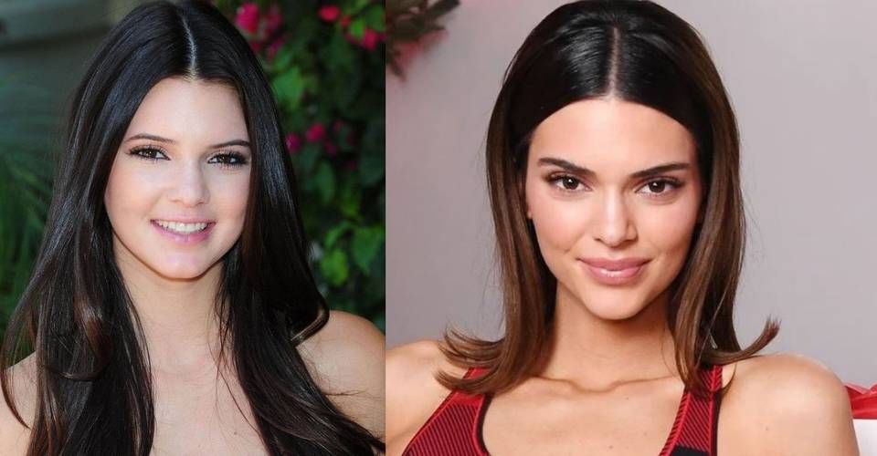 Keeping Up With The Kardashians Kendall Jenner Plastic Surgery Facts