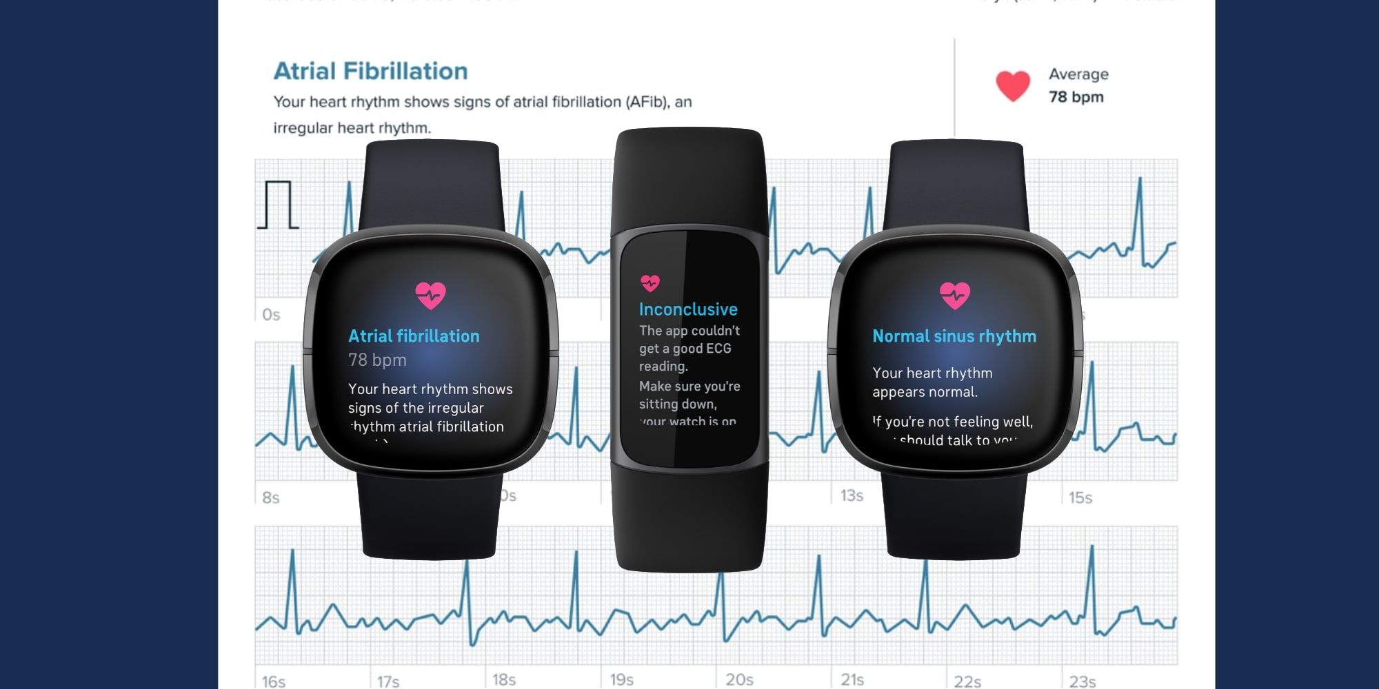 fitbit with ecg